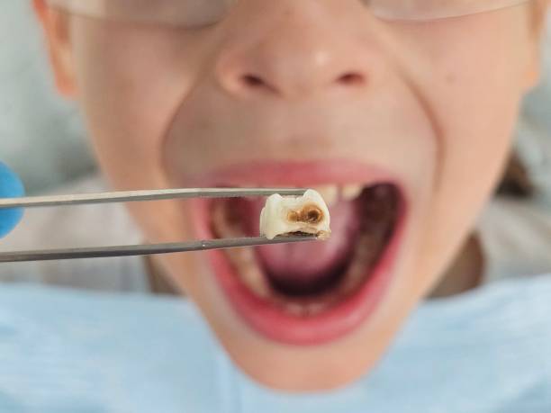 Best Broken or Cracked Tooth Emergency Dentist in Leilani Estates, HI